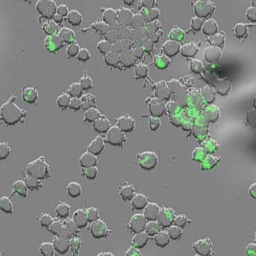 Mycobacterium tuberculosis (green) inside human immune cells known as macrophages.